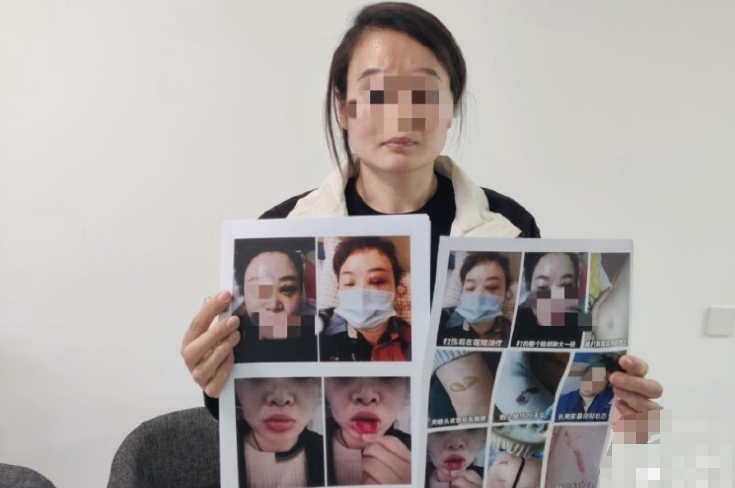 鄭州一女子稱被企業(yè)家丈夫長期家暴,起訴離婚要撫養(yǎng)權(quán)